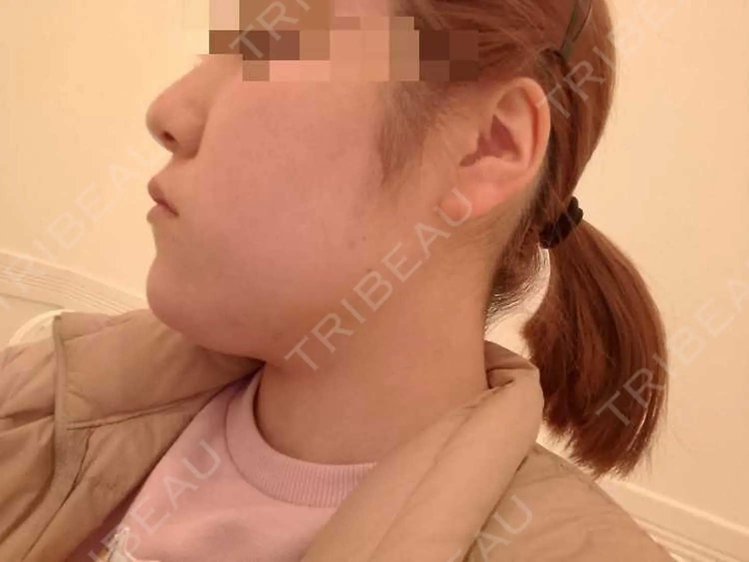 施術前の写真
