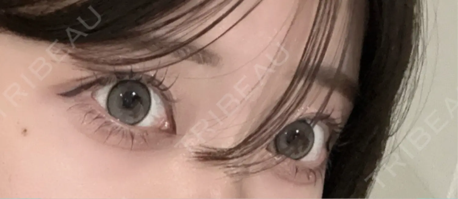 施術前の写真