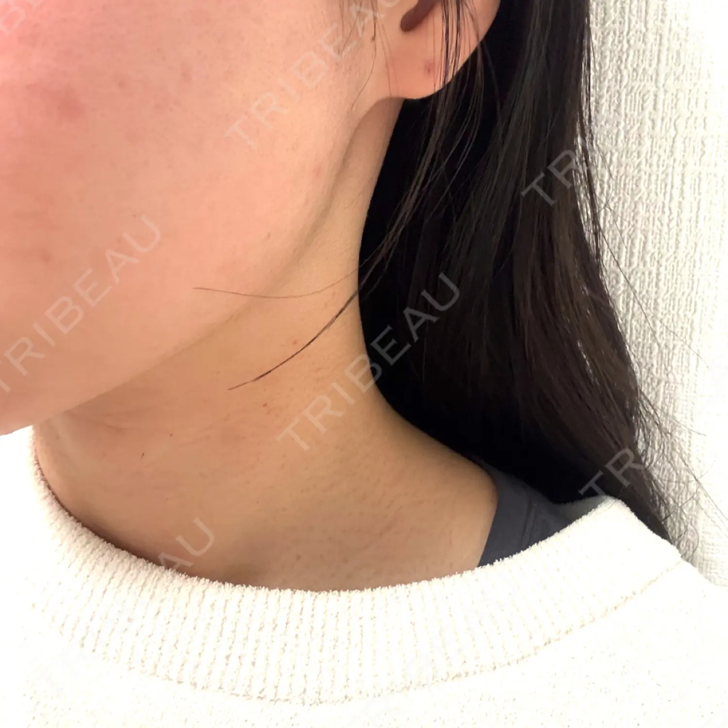 施術前の写真