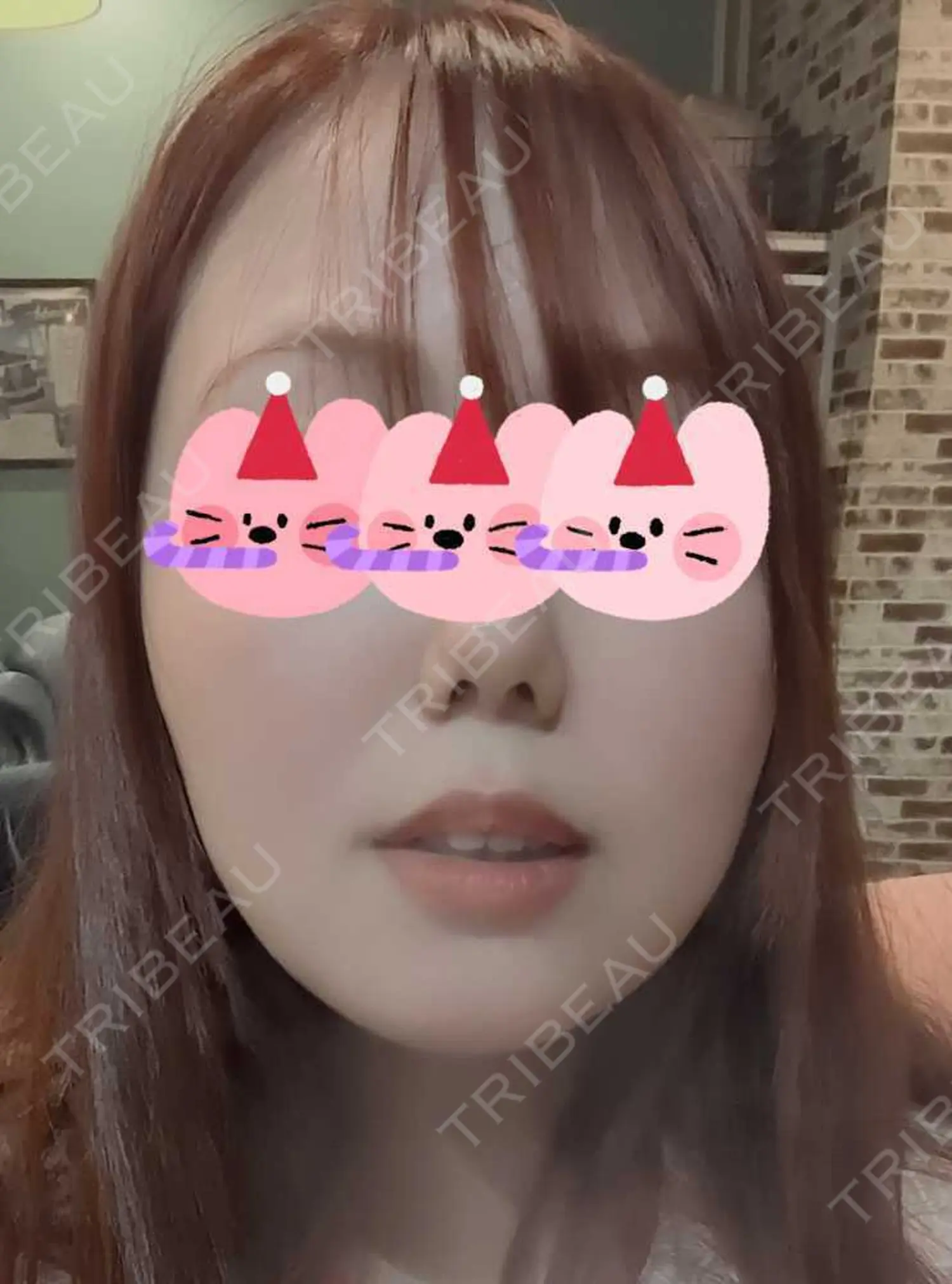 施術前の写真