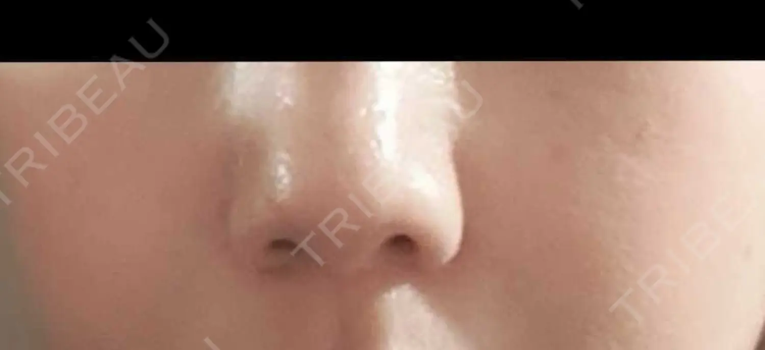 施術前の写真