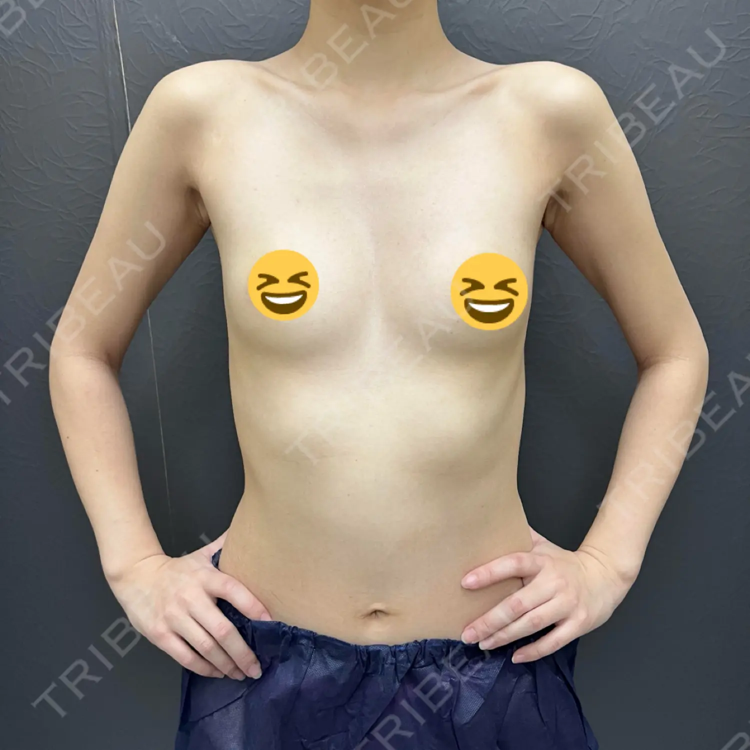 施術前の写真
