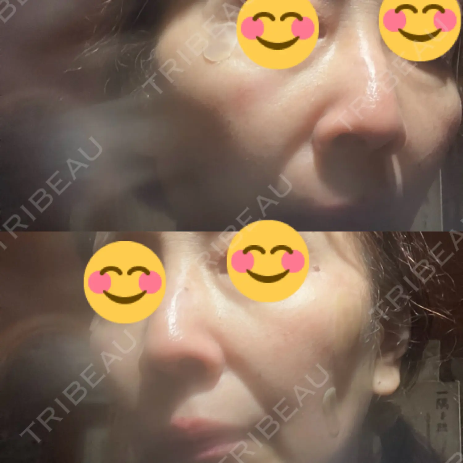 施術前の写真