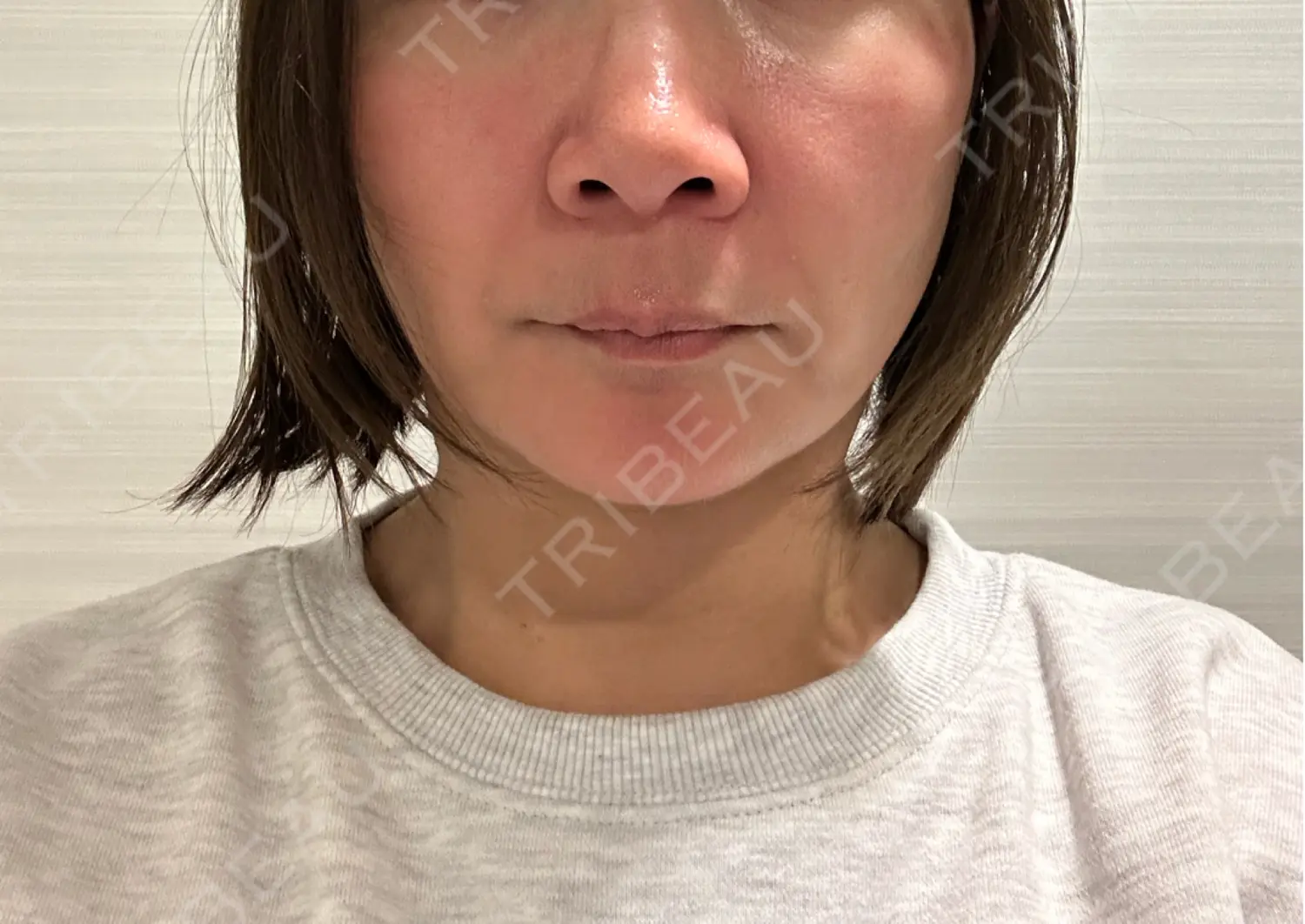 施術前の写真