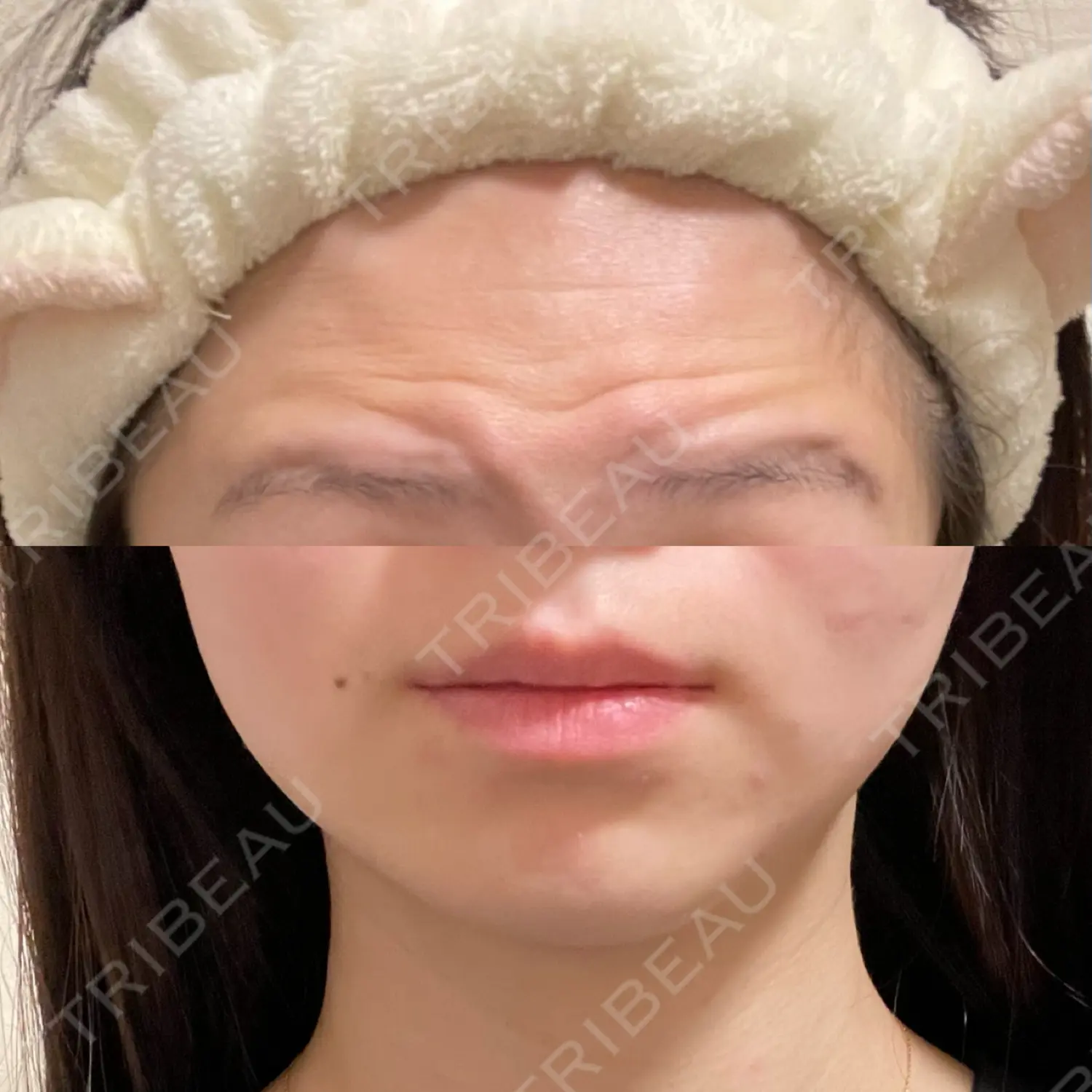 施術前の写真