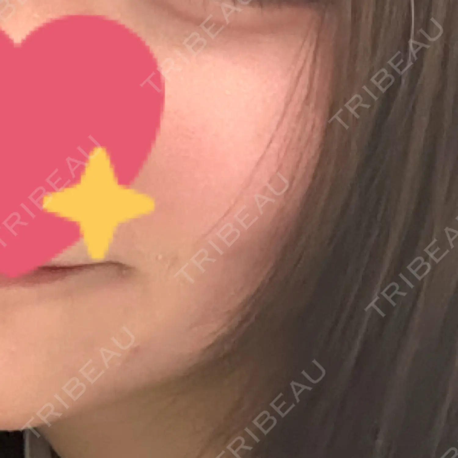 施術前の写真