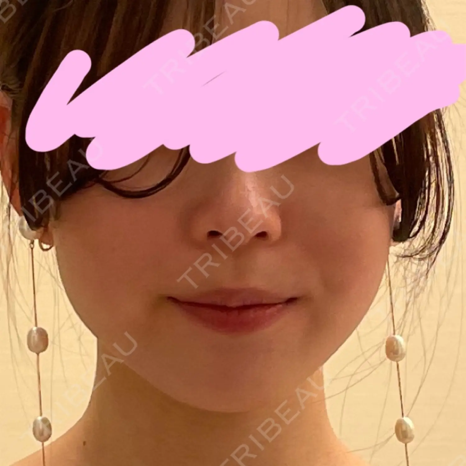 施術前の写真