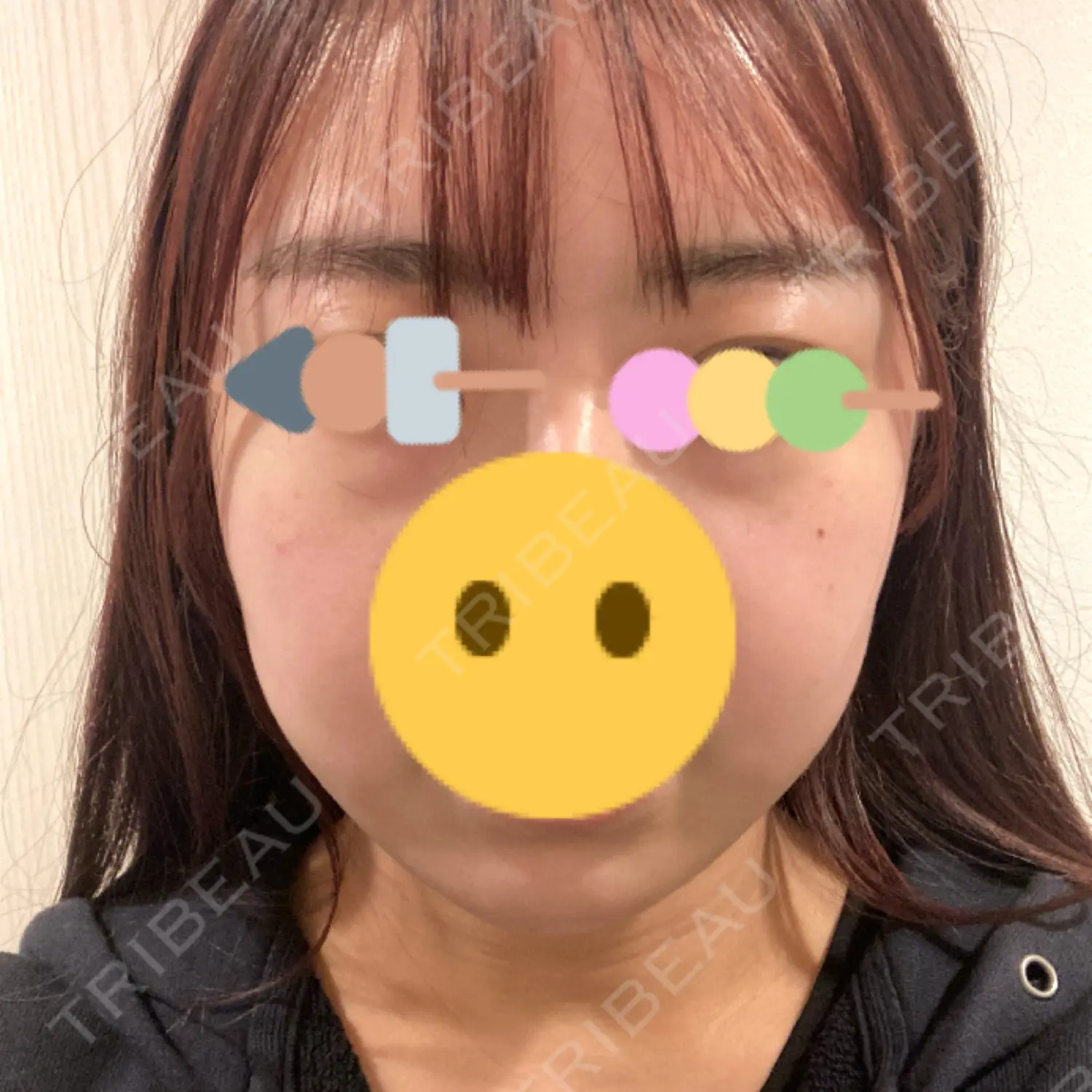 施術前の写真
