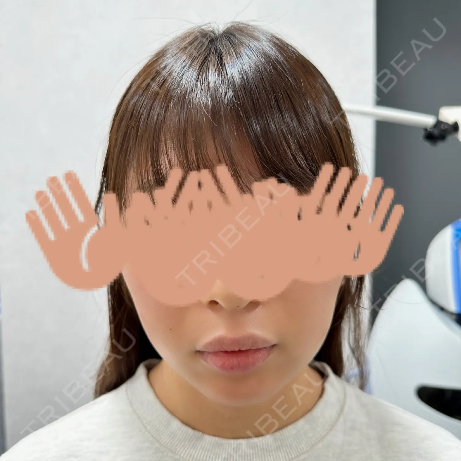 施術前の写真