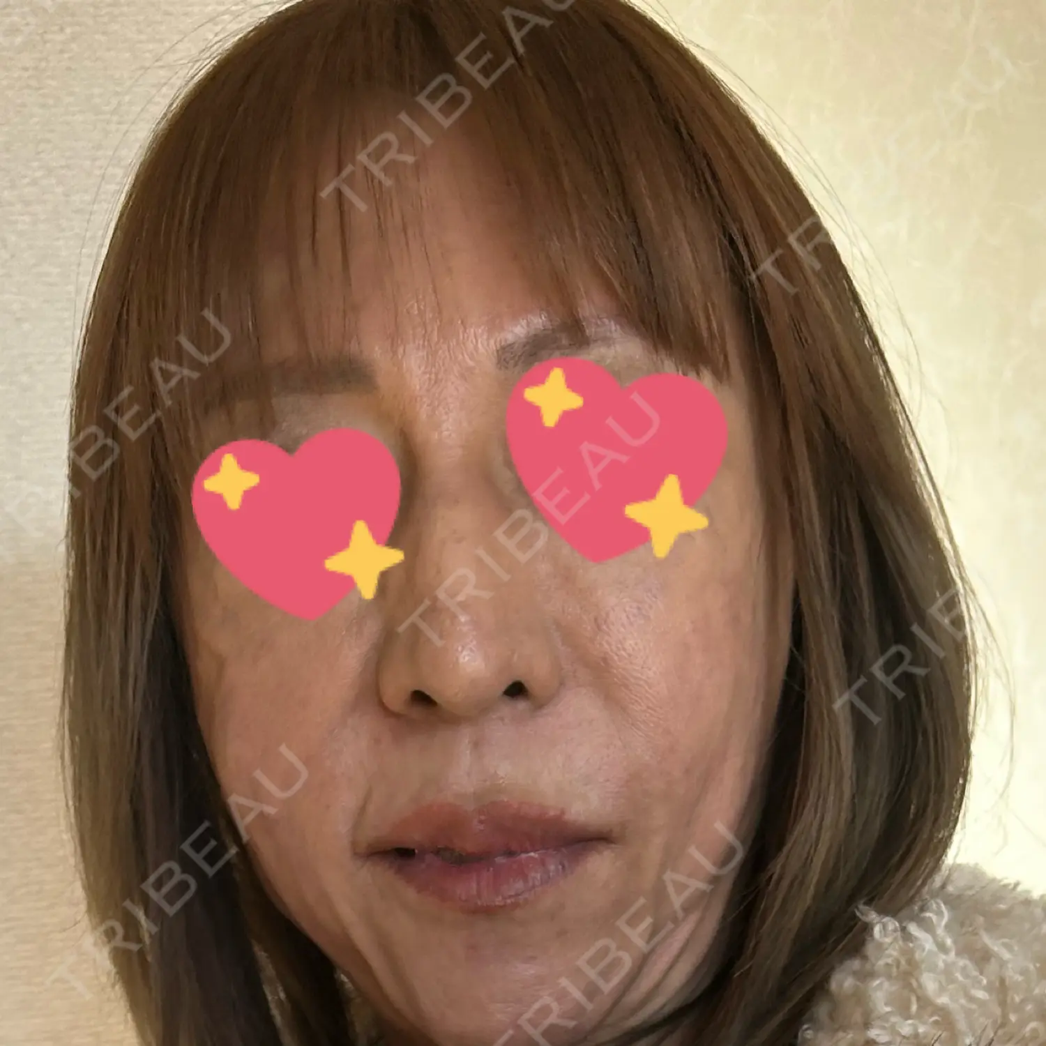 施術前の写真