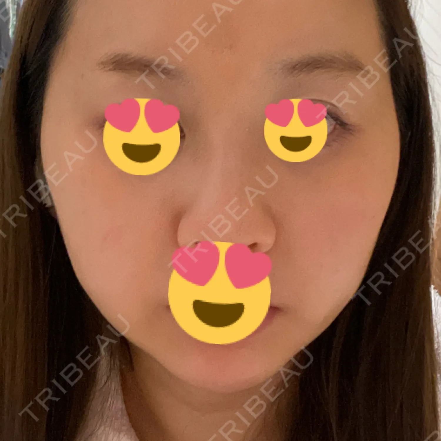 施術前の写真