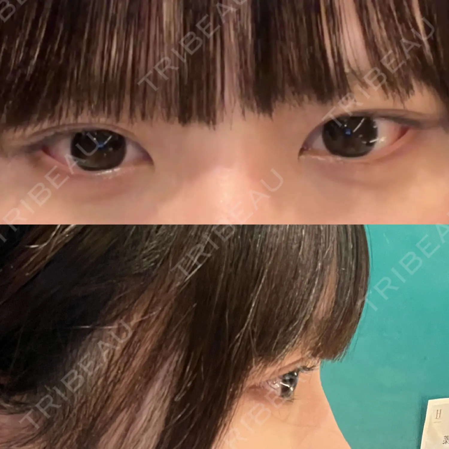 施術前の写真