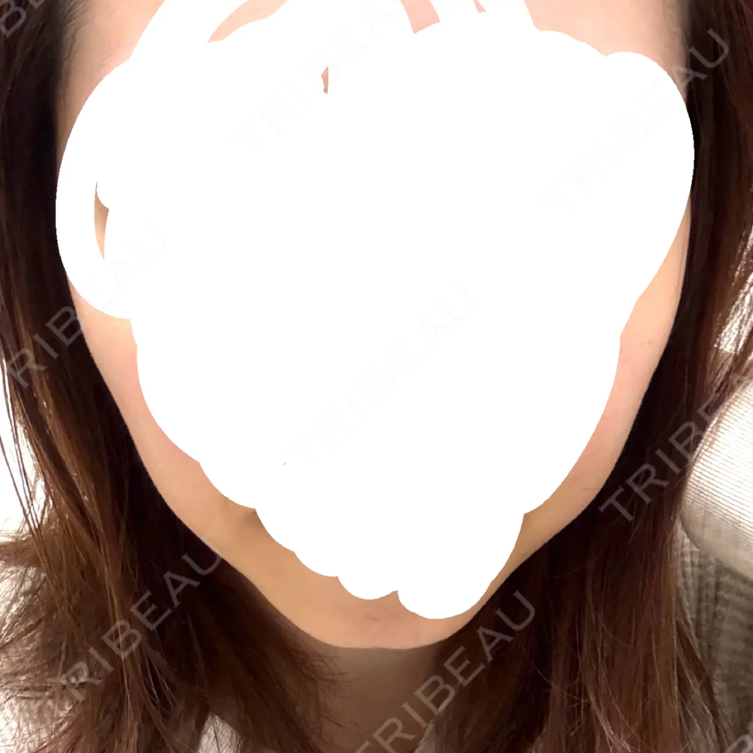 施術前の写真