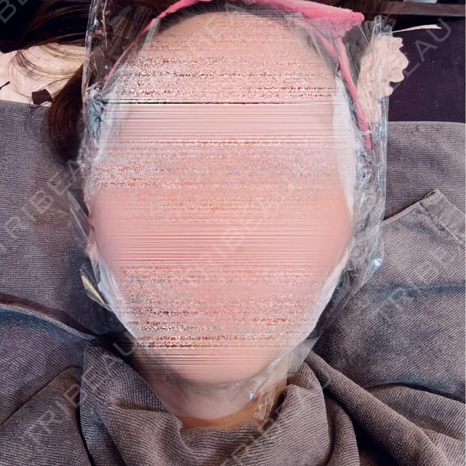 施術前の写真