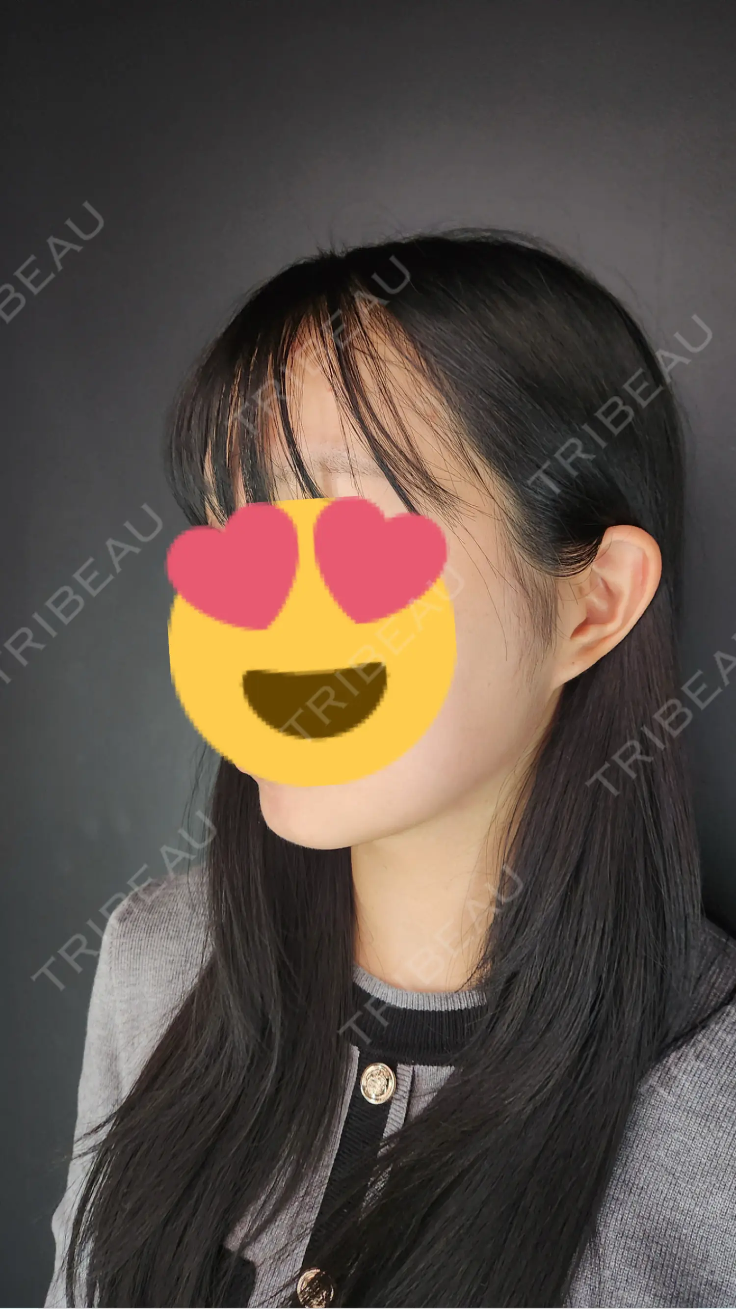 施術前の写真