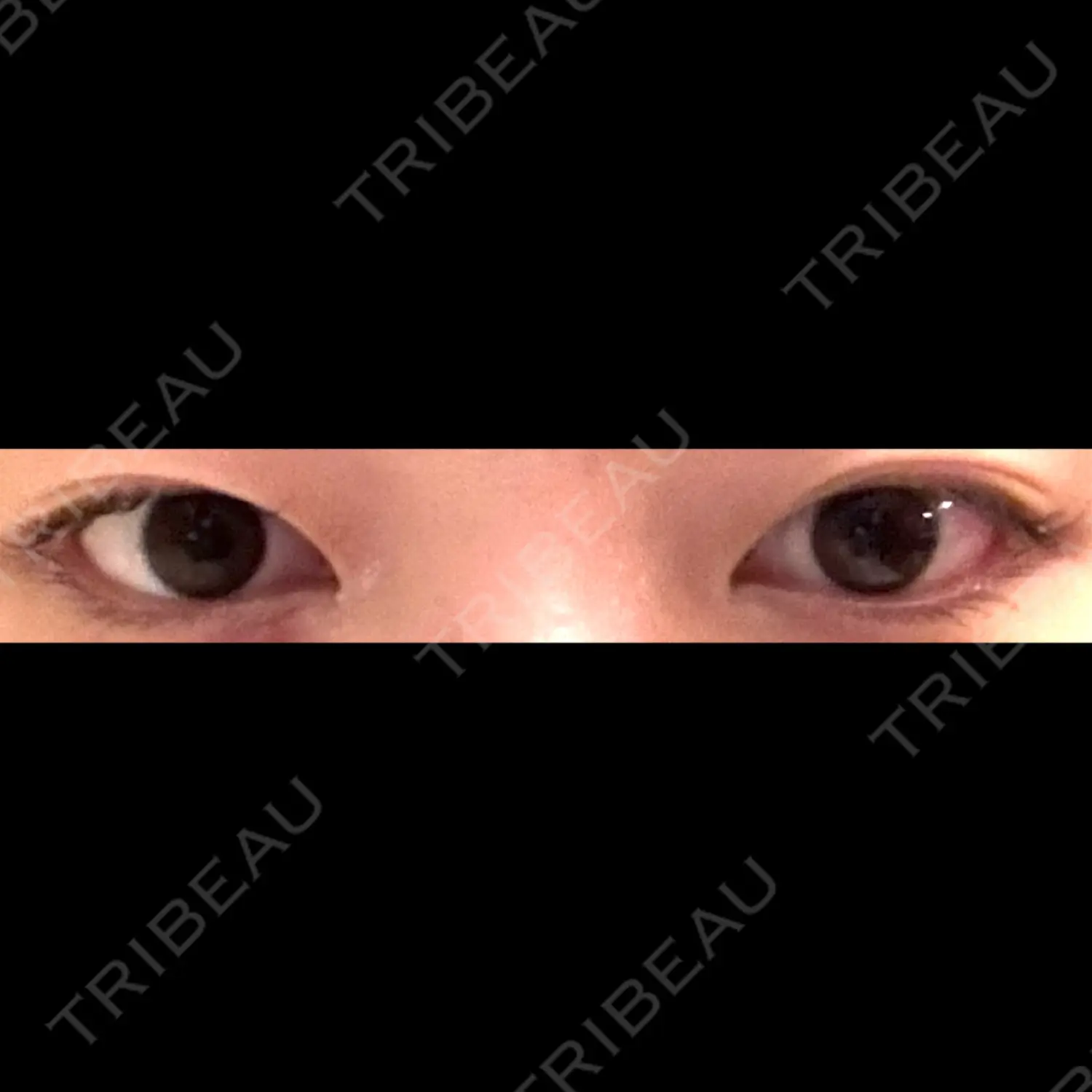 施術前の写真