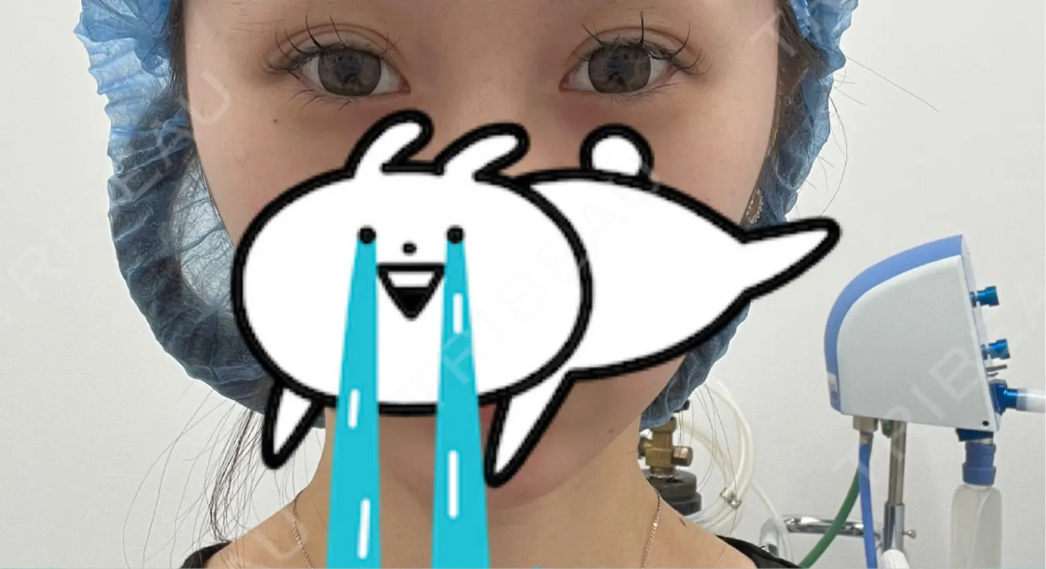 施術前の写真