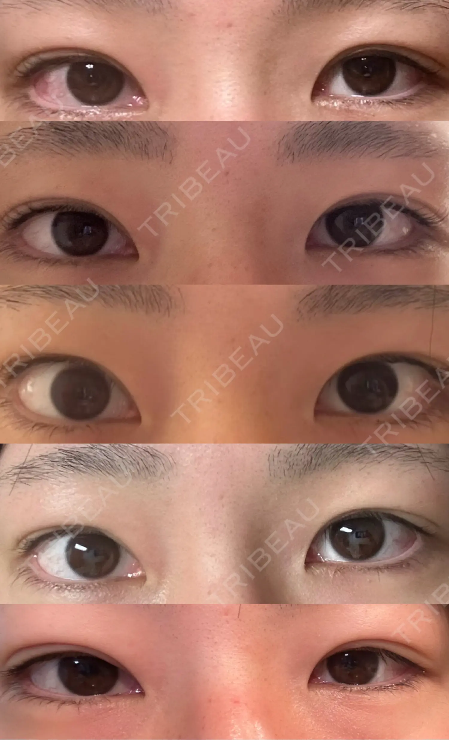 施術前の写真