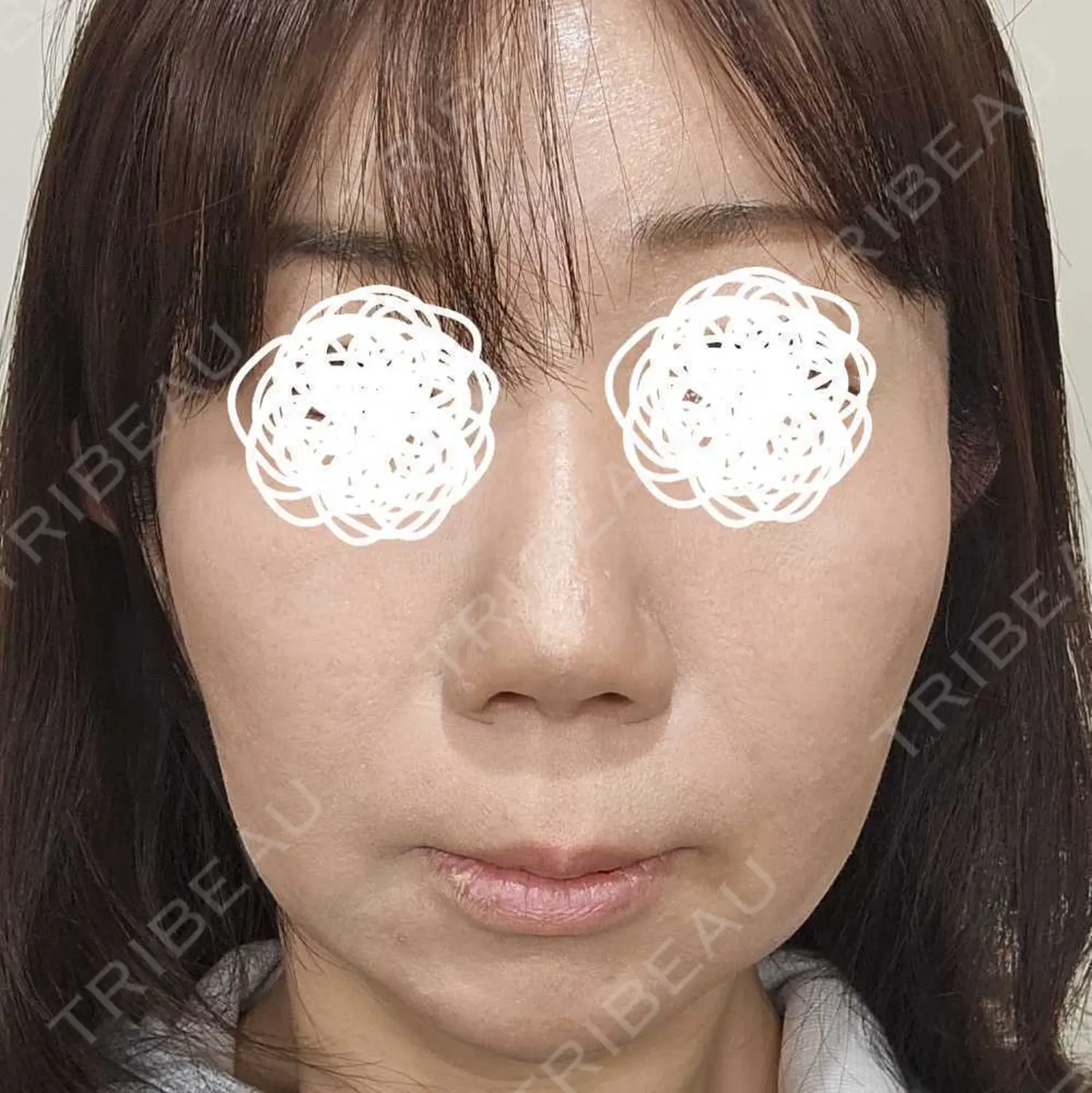 施術前の写真