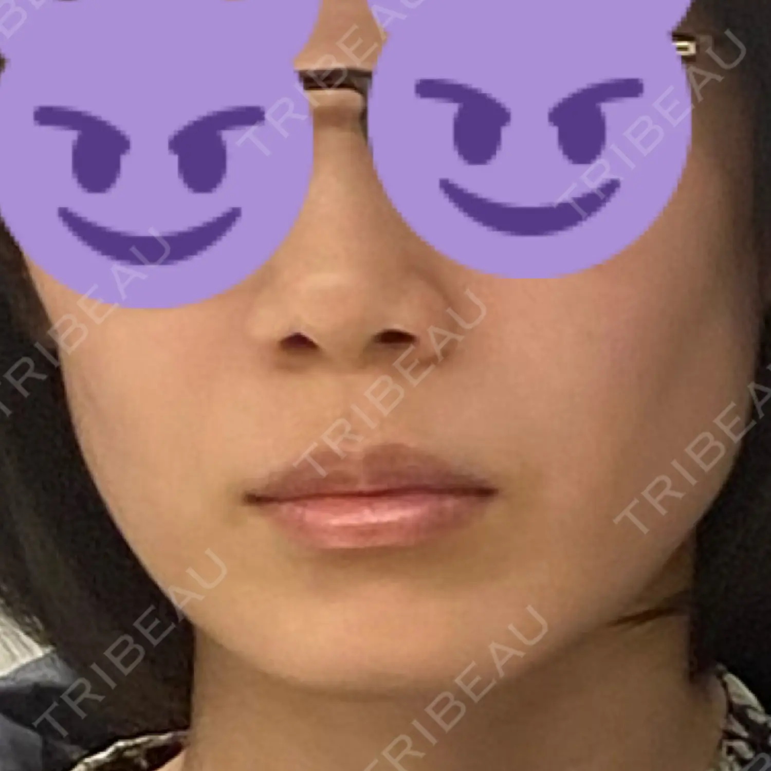 施術前の写真