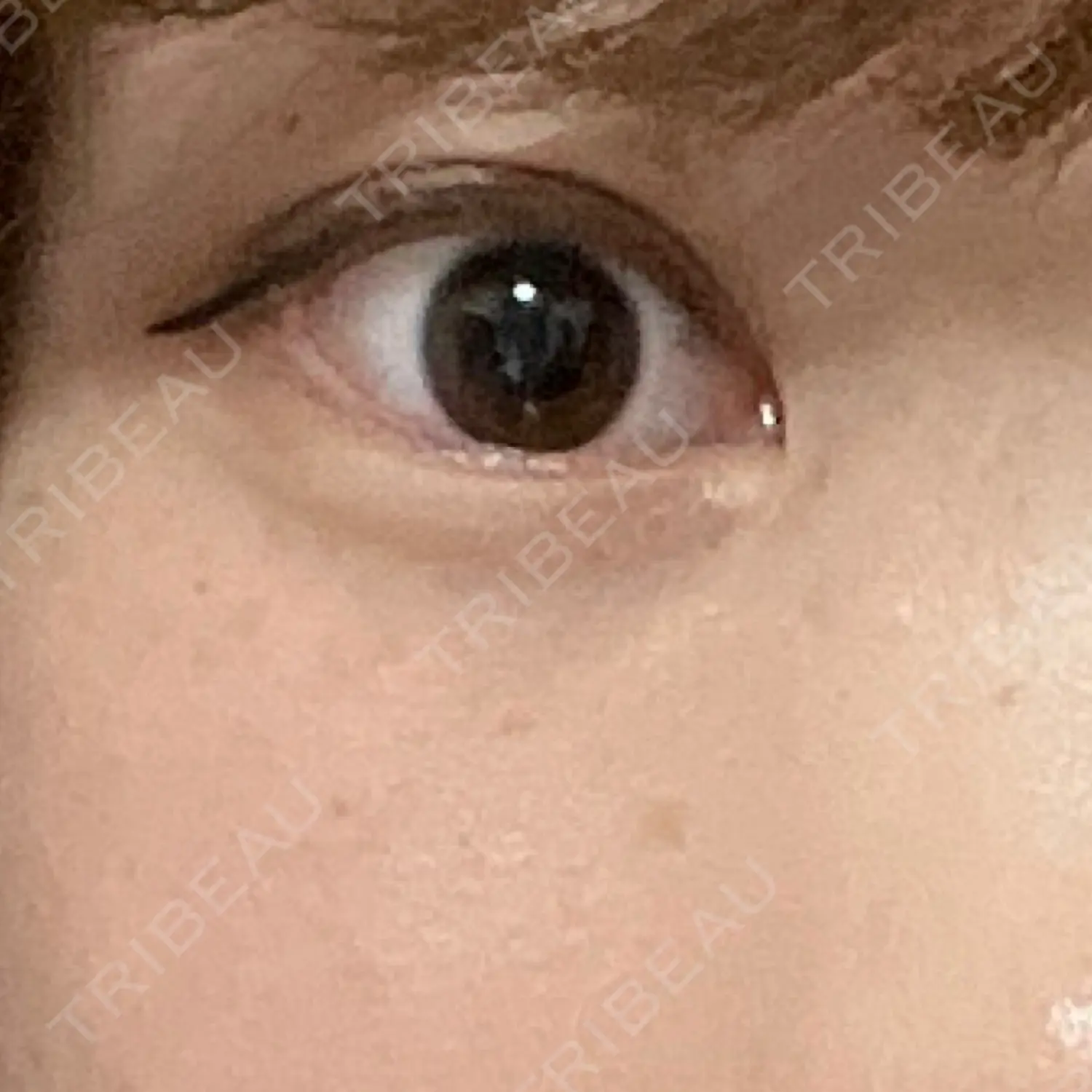 施術前の写真