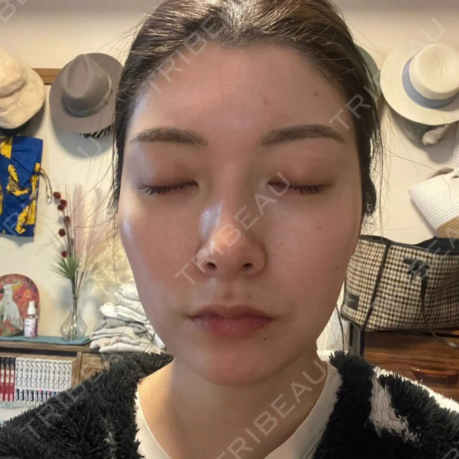 施術前の写真