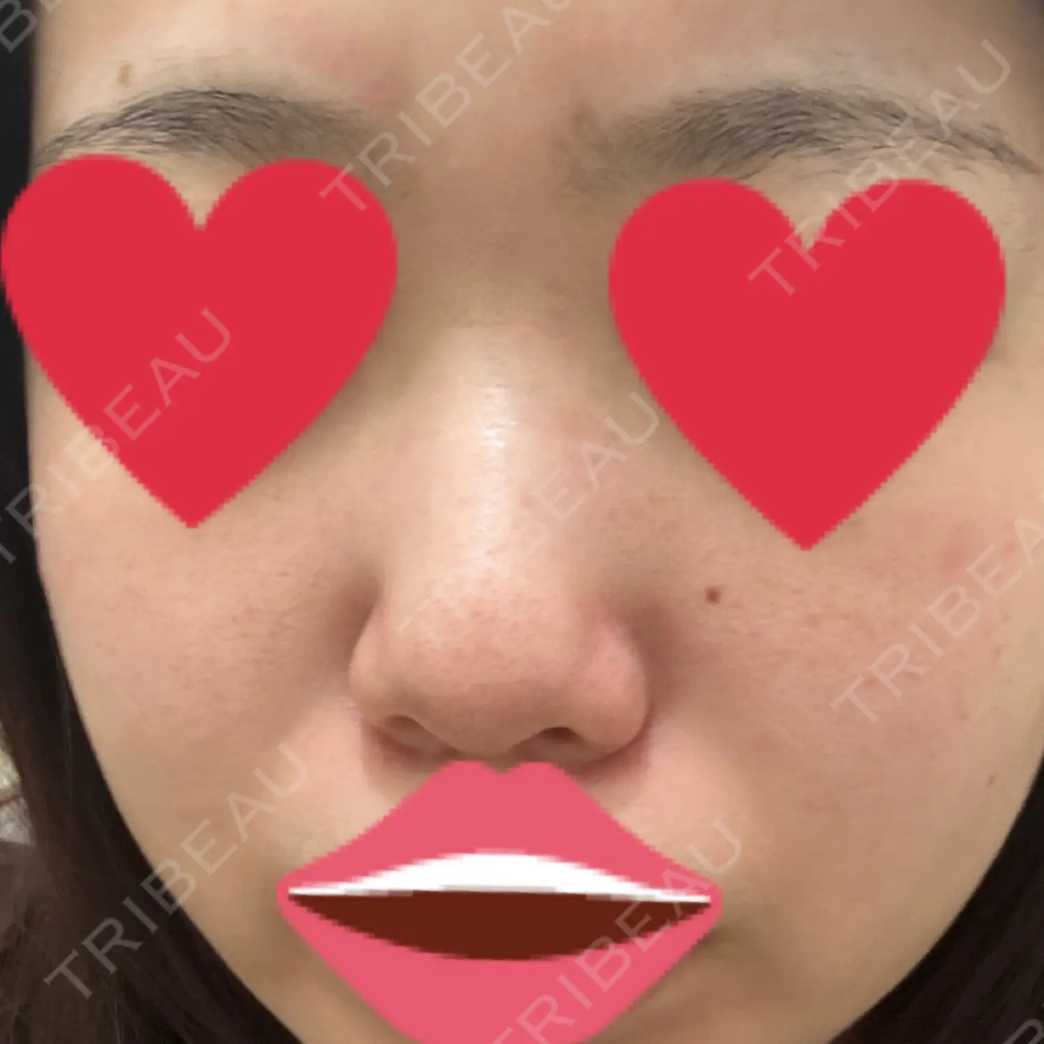 施術前の写真