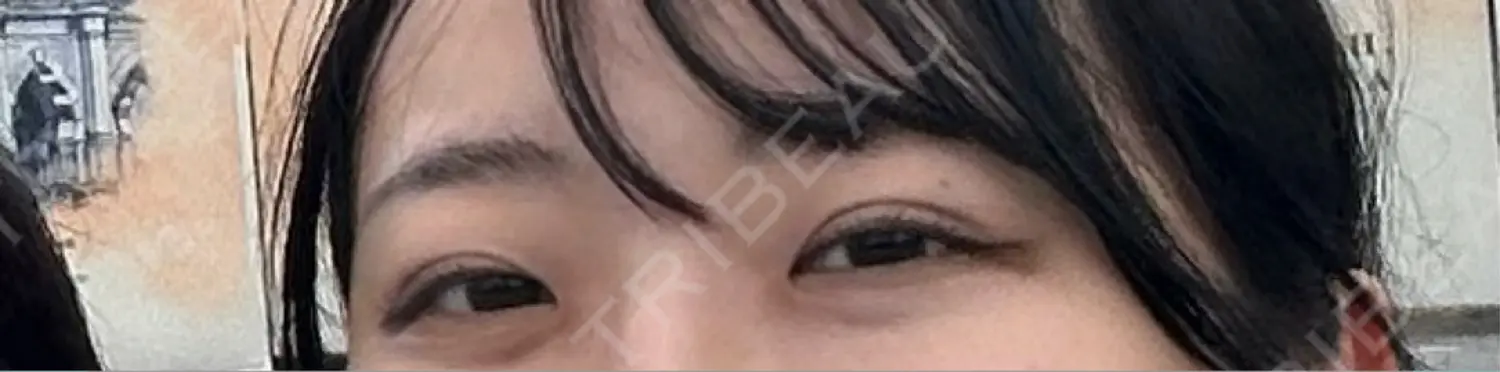 施術前の写真