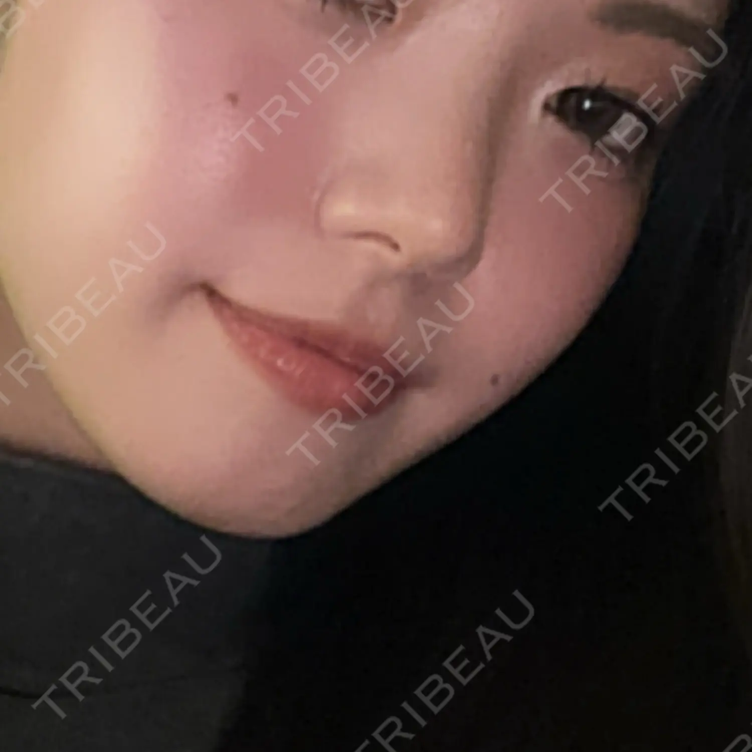 施術前の写真