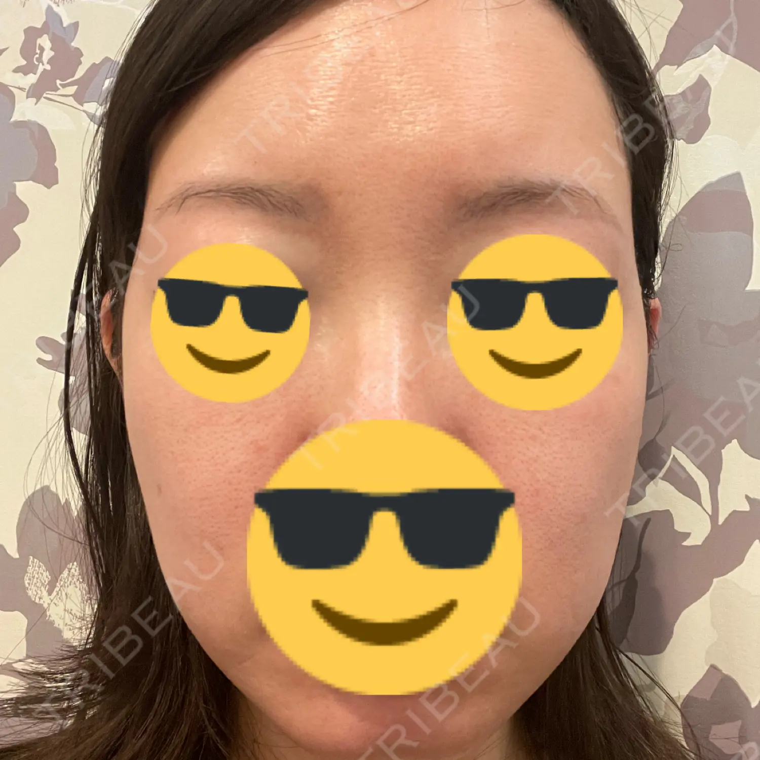 施術前の写真