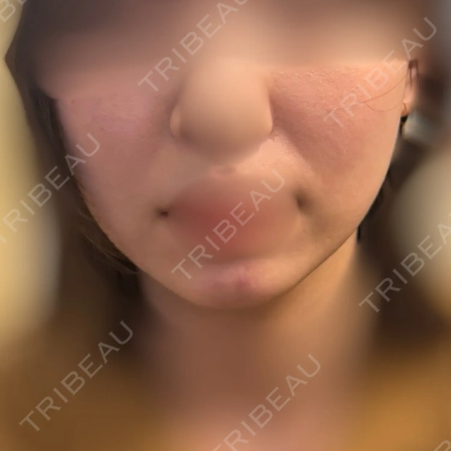 施術前の写真