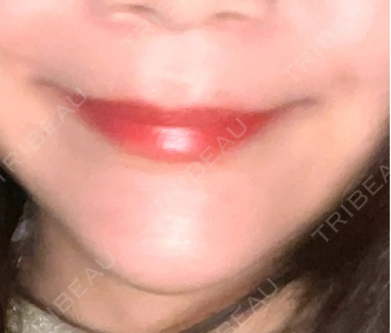 施術前の写真