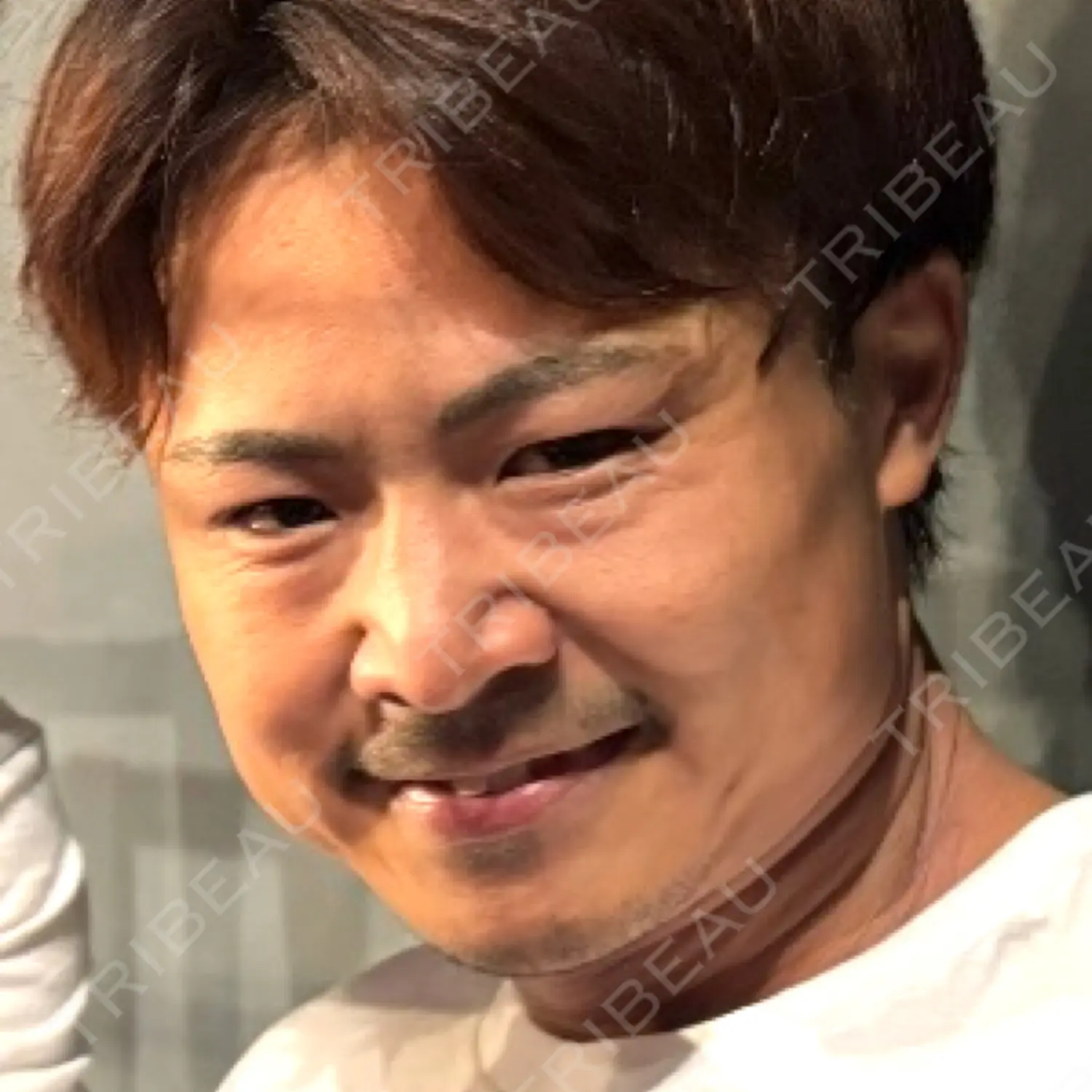 施術前の写真