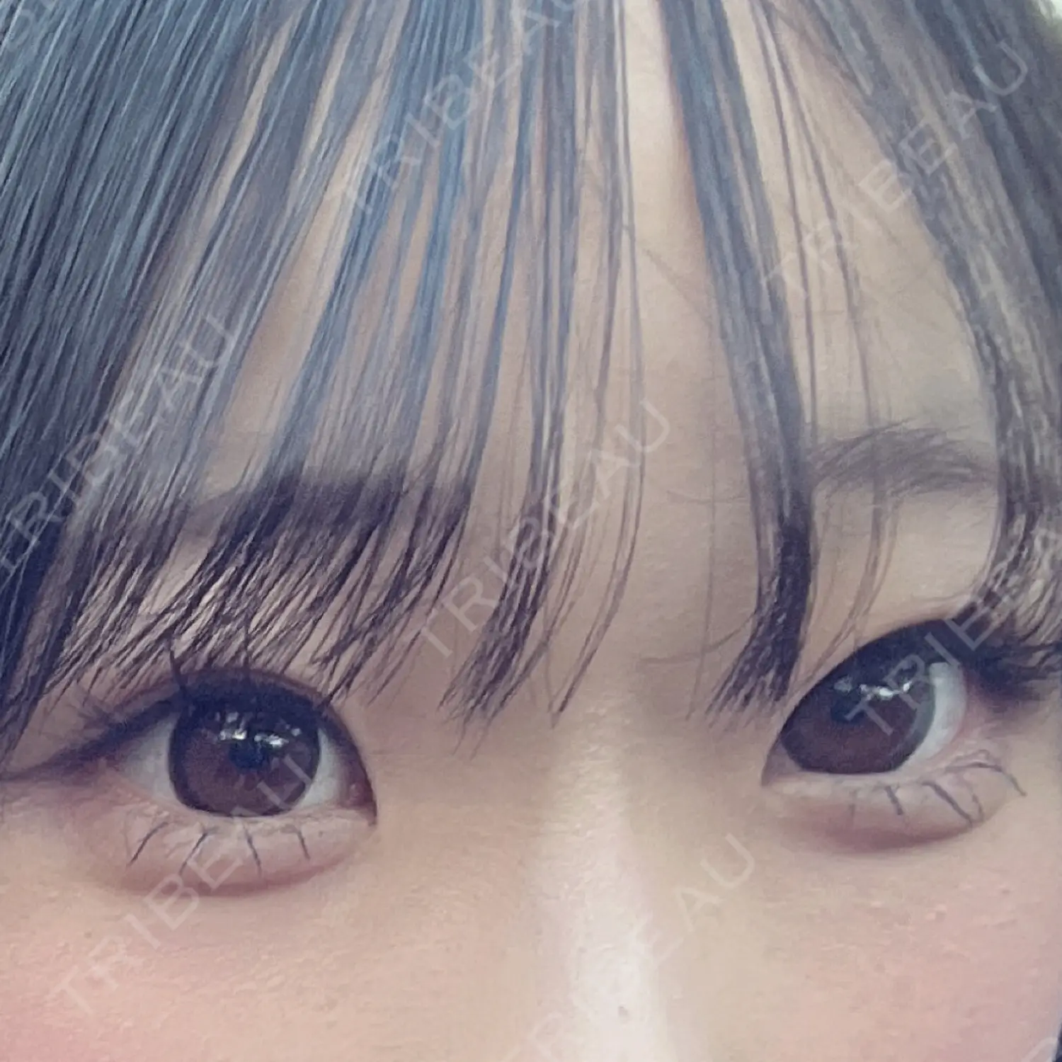 施術前の写真