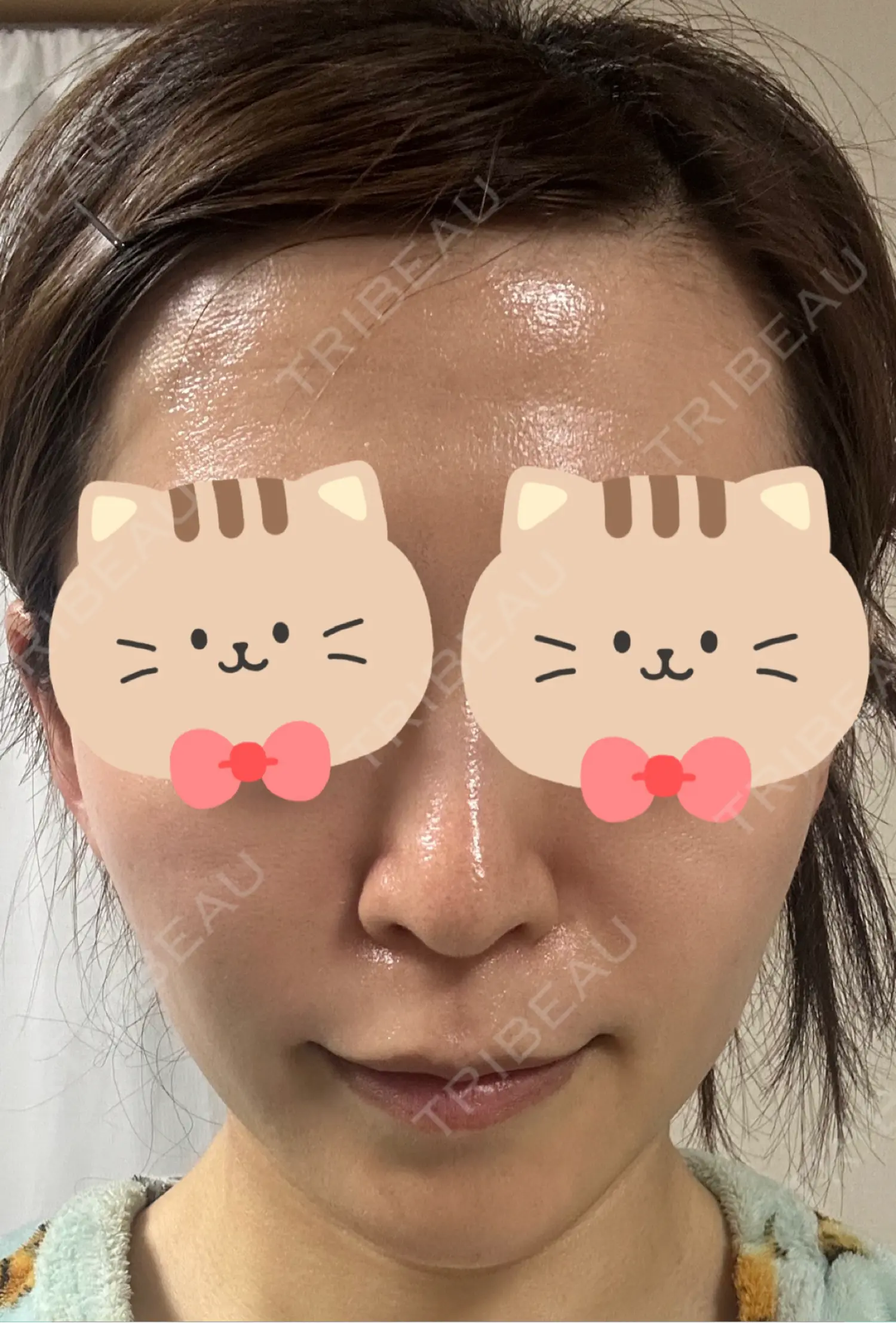 施術前の写真