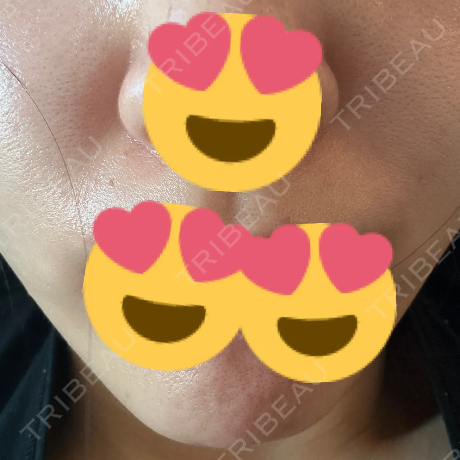 施術前の写真