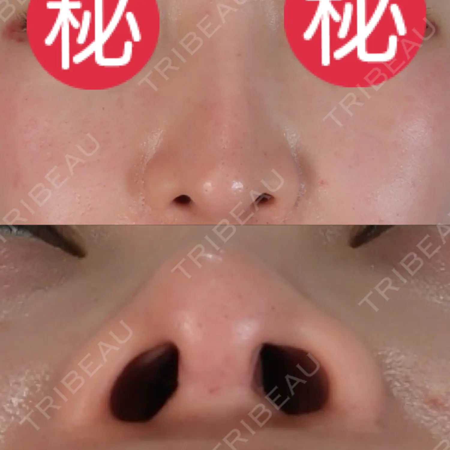 施術前の写真