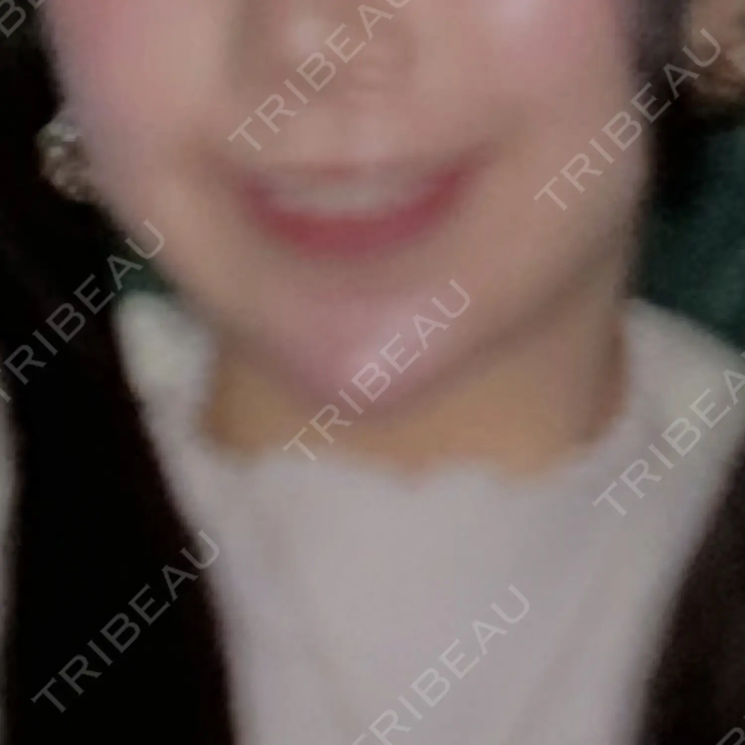 施術前の写真