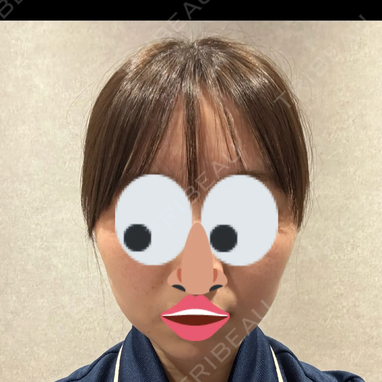 施術前の写真