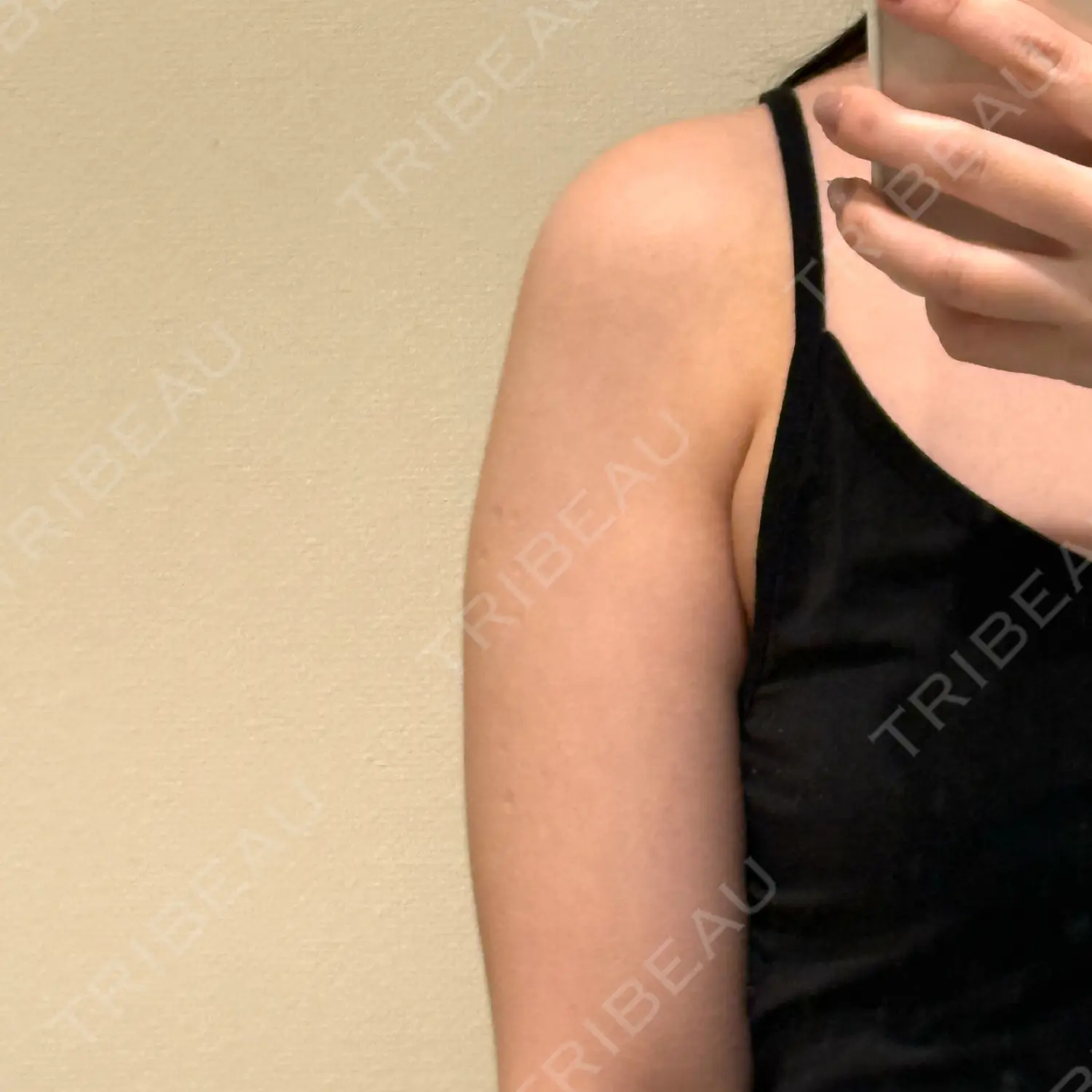 施術前の写真