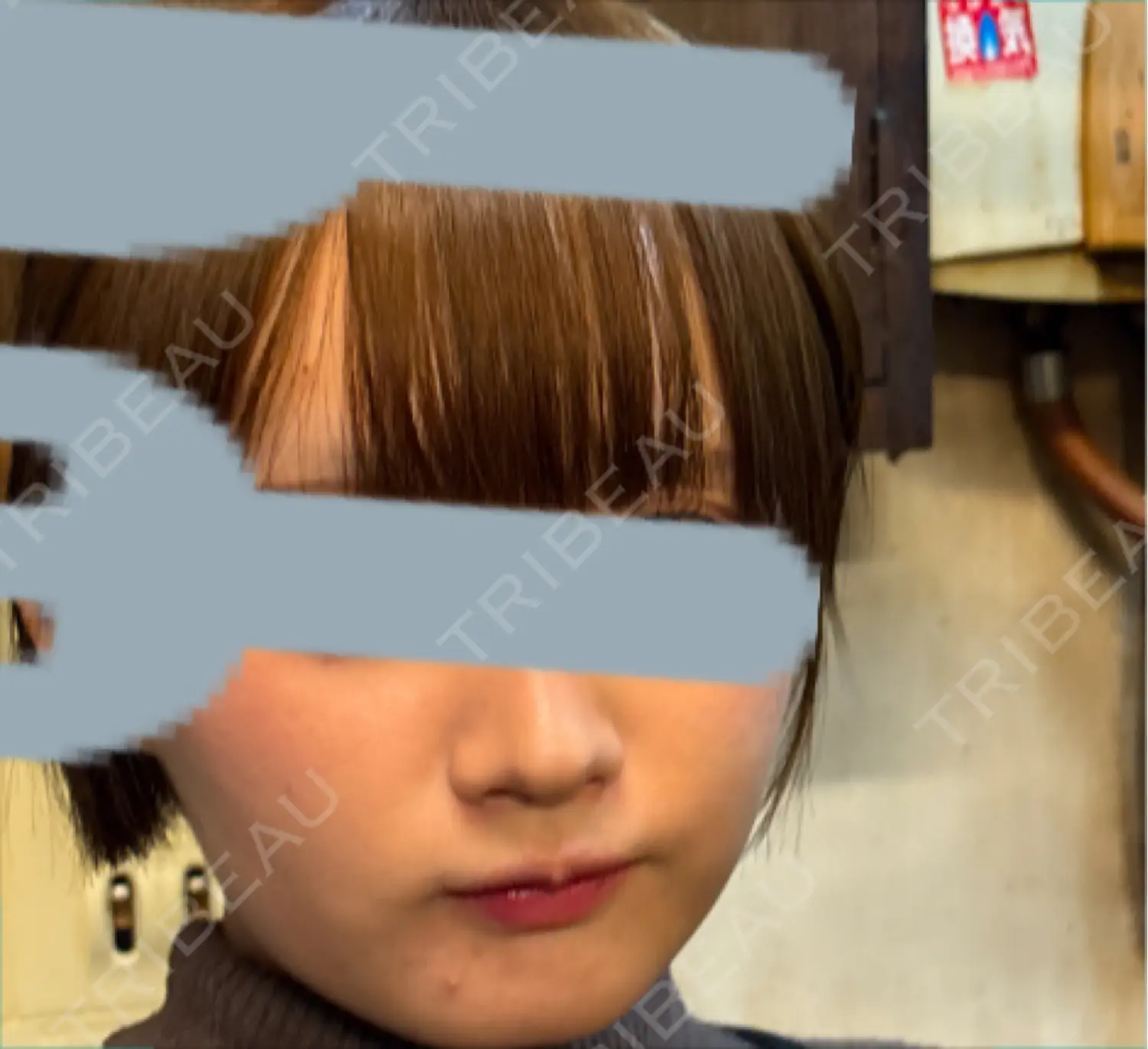 施術前の写真