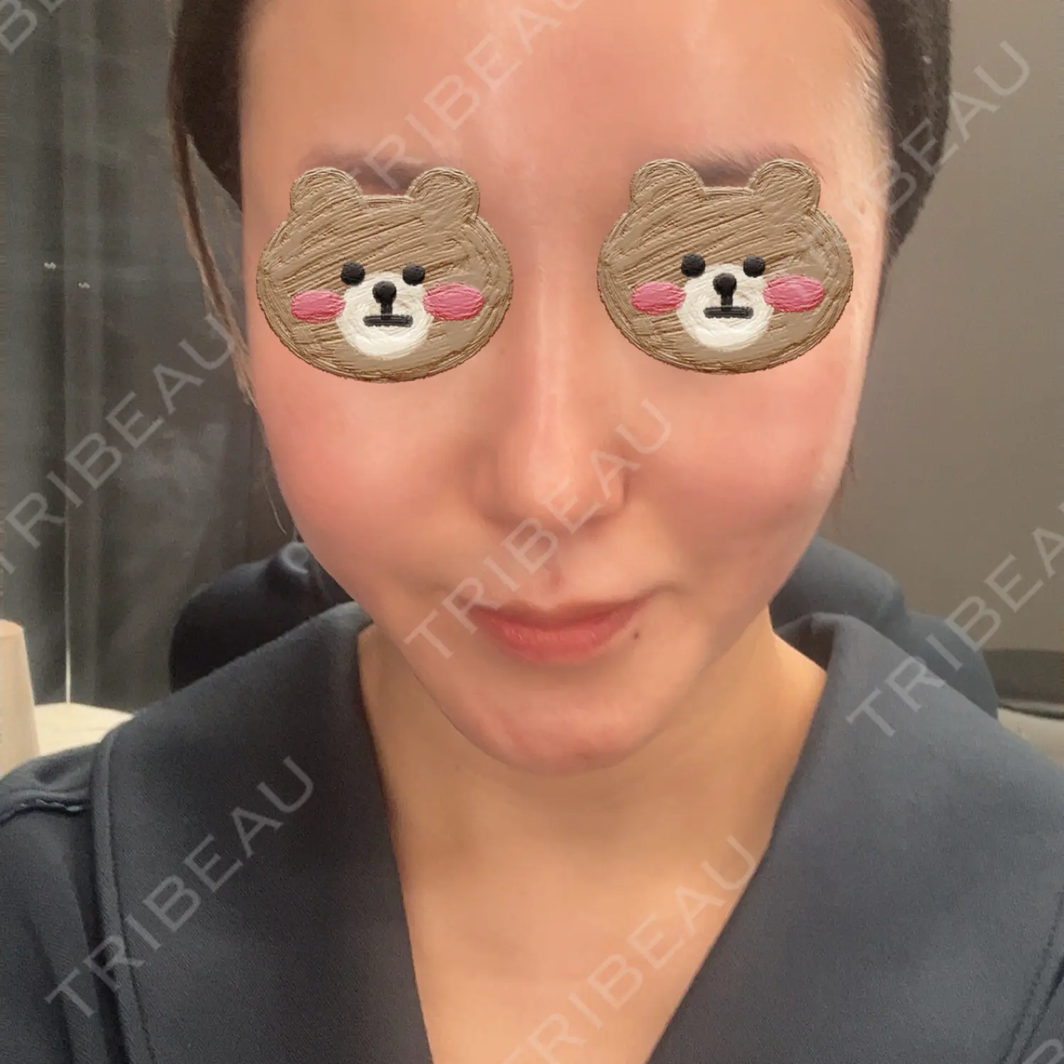 施術前の写真
