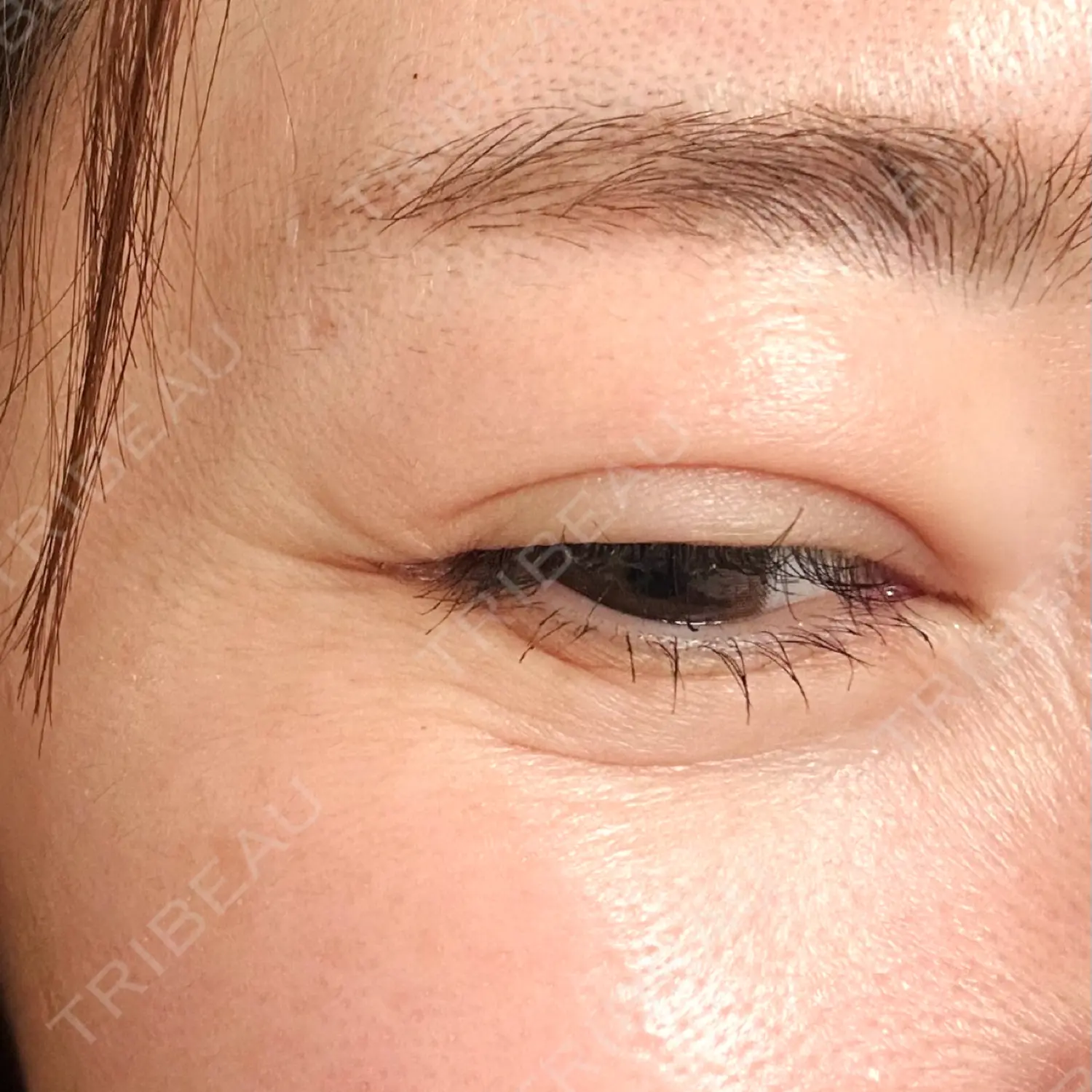 施術前の写真