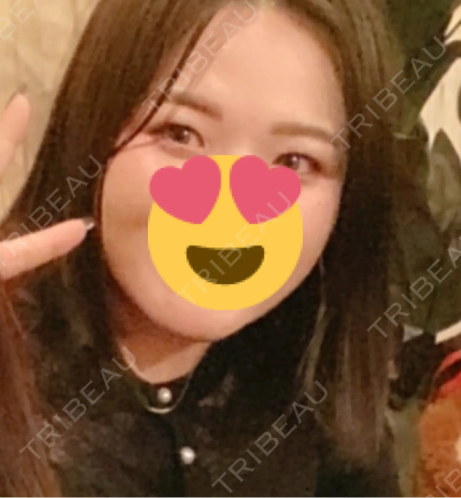 施術前の写真