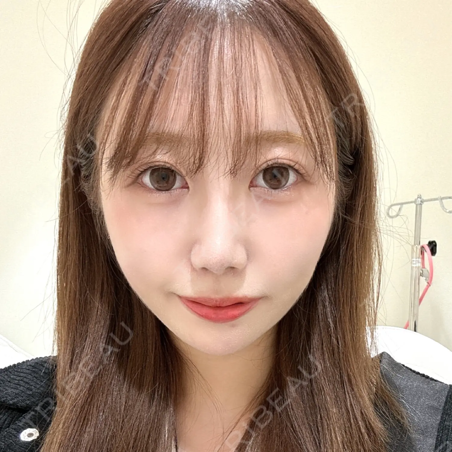 施術前の写真