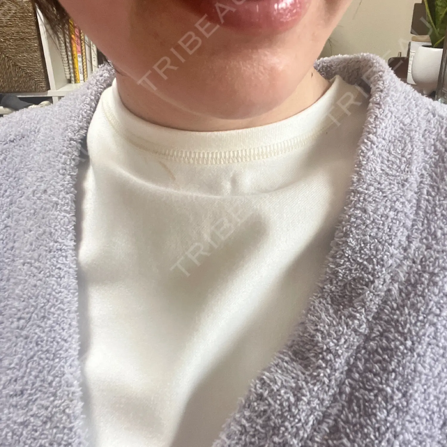 施術前の写真