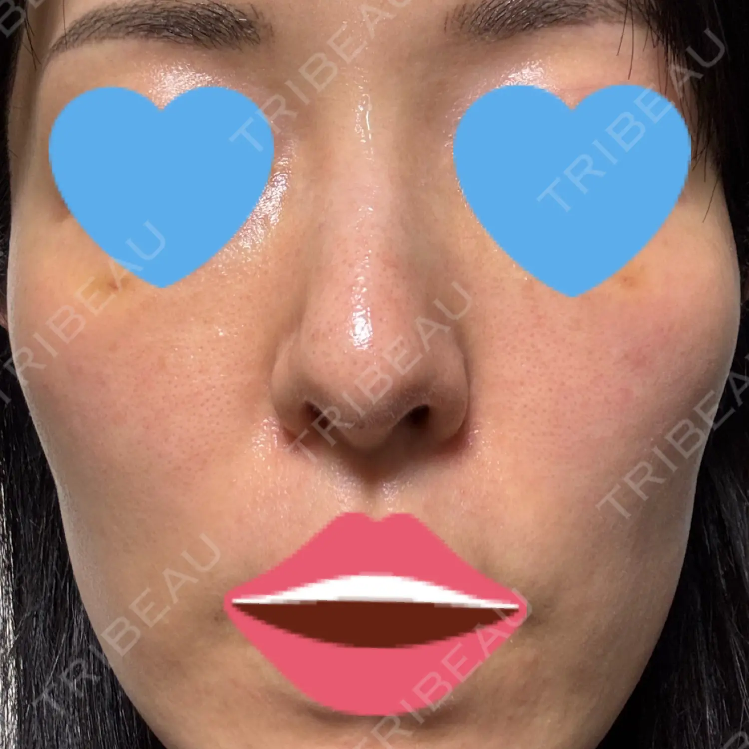 施術前の写真
