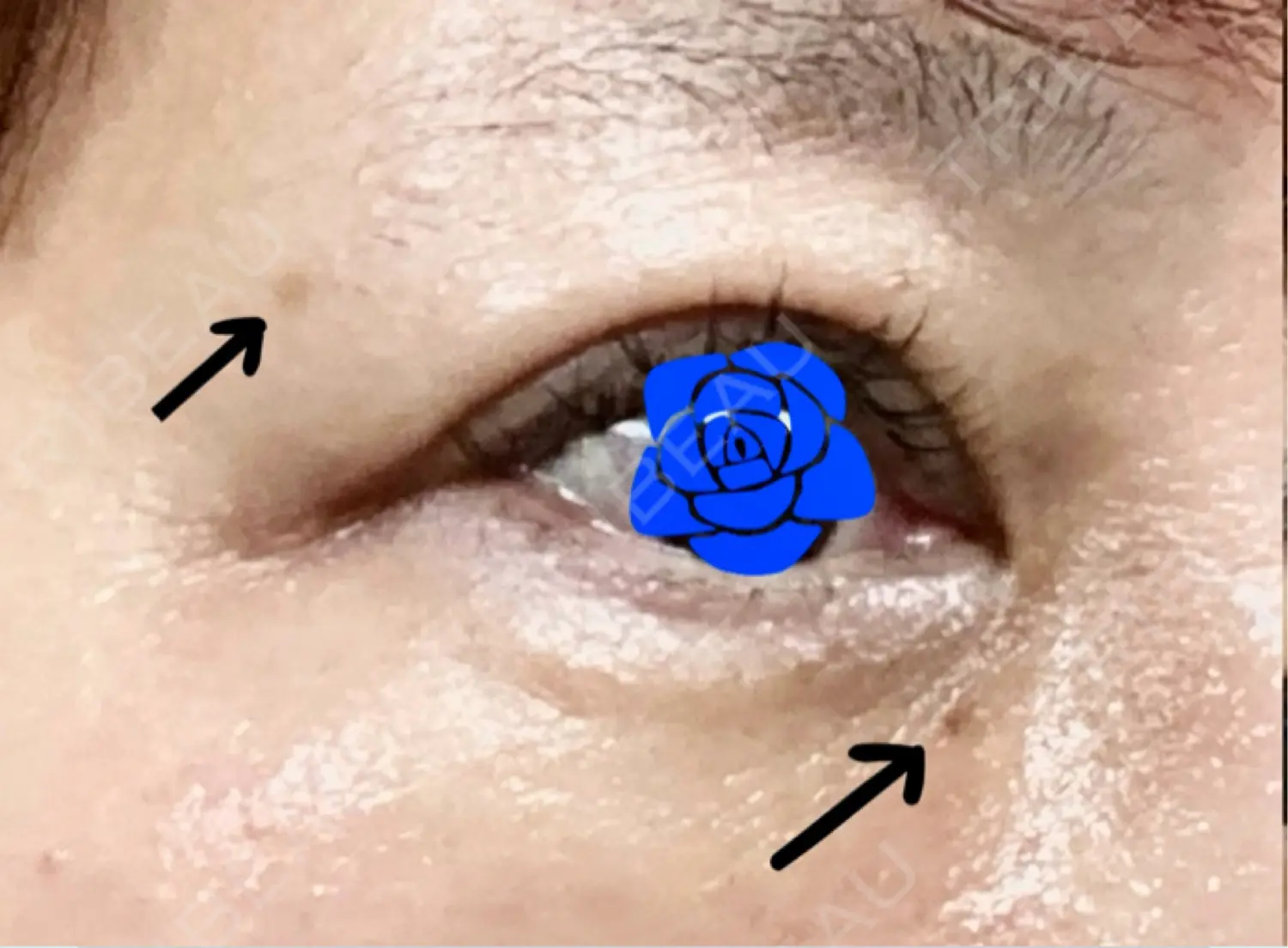 施術前の写真