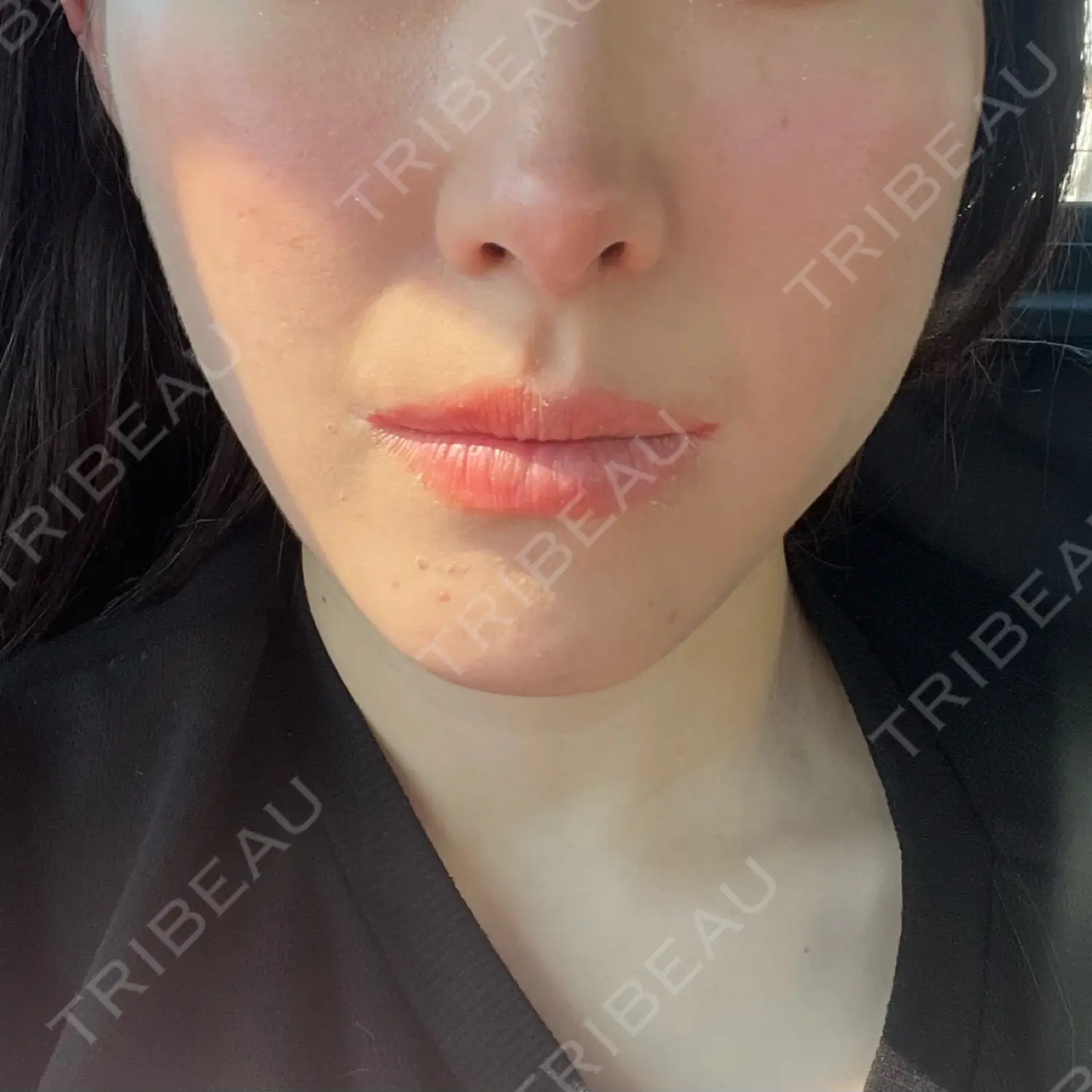 施術前の写真