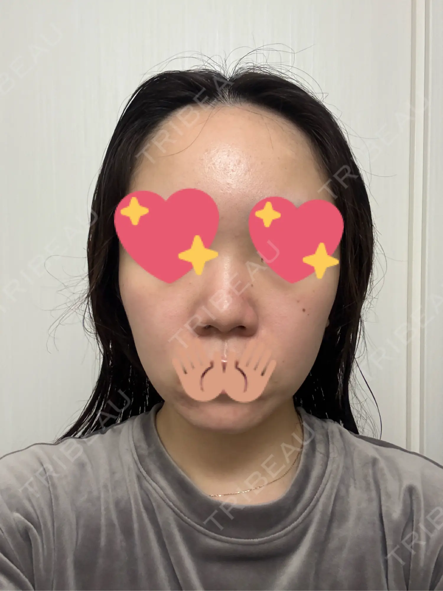 施術前の写真
